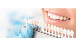 Cosmetic Dentistry
